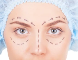 Blepharoplasty of the upper and lower eyelids - 660367 - photo 1 (mini)