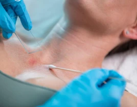 Удаление атеромы - 660371 - фото 1 (mini)